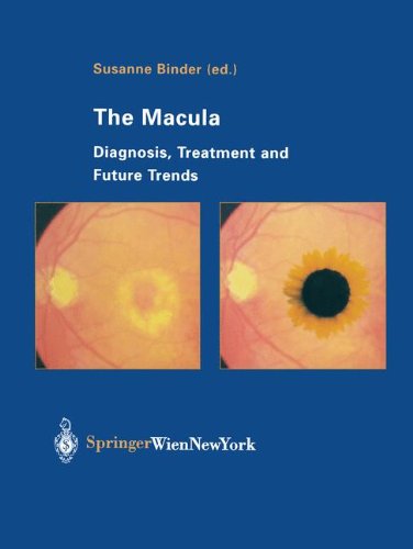 The Macula: Diagnosis, Treatment and Future Trends [Paperback]