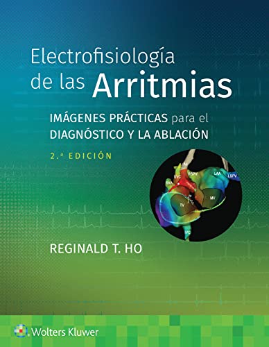 Electrofisiolog&237a de las arritmias Im&225genes pr&225cticas para el di [Paperback]