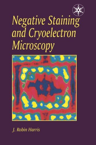 Negative Staining and Cryoelectron Microscopy The Thin Film Techniques [Paperback]