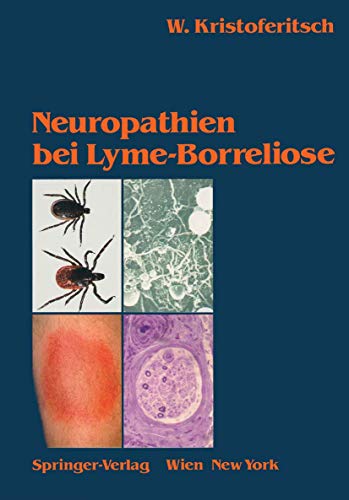 Neuropathien bei Lyme-Borreliose [Paperback]