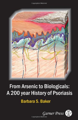 From Arsenic To Biologicals A 200 Year History Of Psoriasis [Paperback]