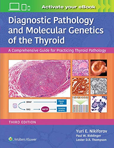 Diagnostic Pathology and Molecular Genetics of the Thyroid A Comprehensive Guid [Hardcover]