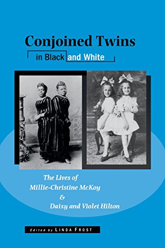 Conjoined Twins in Black and White The Lives of Millie-Christine McKoy and Dais [Paperback]
