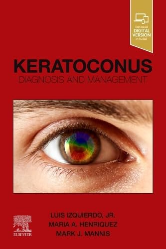 Keratoconus Diagnosis and Management [Paperback]