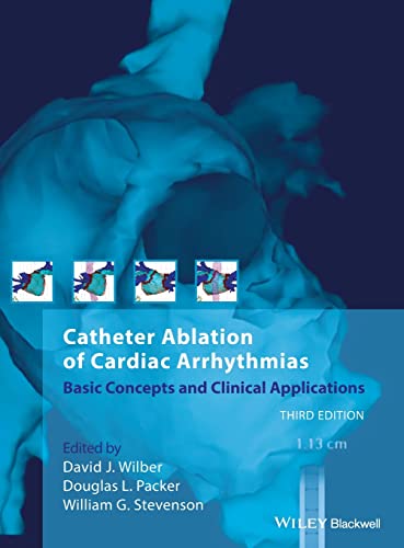 Catheter Ablation of Cardiac Arrhythmias Basic Concepts and Clinical Applicatio [Hardcover]