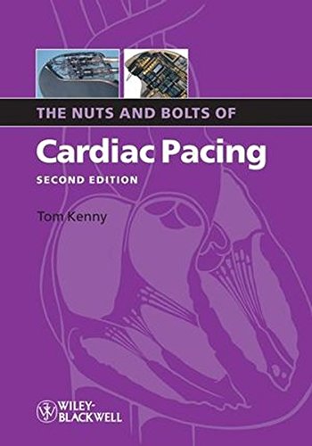 The Nuts and Bolts of Cardiac Pacing [Paperback]