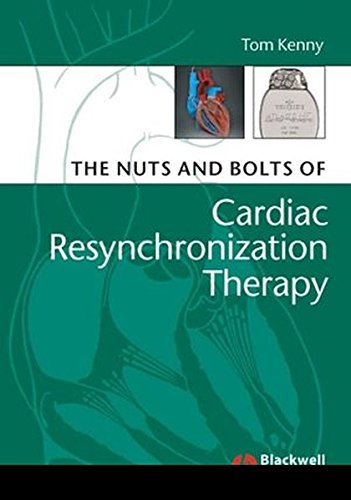The Nuts and Bolts of Cardiac Resynchronization Therapy [Paperback]