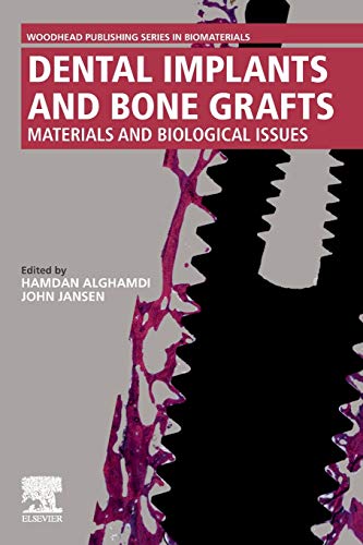 Dental Implants and Bone Grafts Materials and Biological Issues [Paperback]