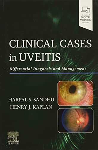 Clinical Cases in Uveitis Differential Diagnosis and Management [Paperback]