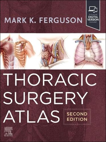 Thoracic Surgery Atlas [Hardcover]