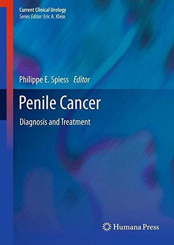 Penile Cancer Diagnosis and Treatment [Hardcover]