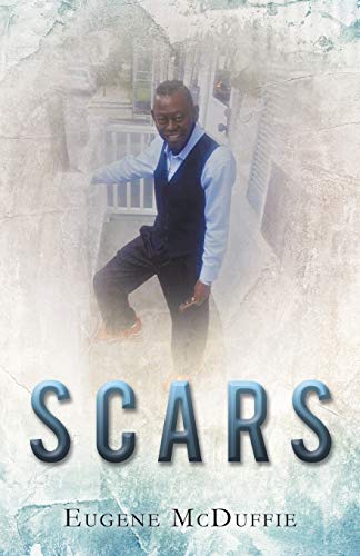 Scars [Paperback]