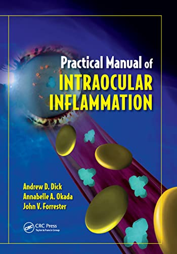 Practical Manual of Intraocular Inflammation [Paperback]