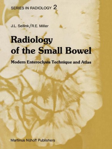 Radiology of the Small Bowel: Modern Enteroclysis Technique and Atlas [Paperback]