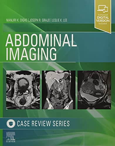 Abdominal Imaging Case Review Series [Paperback]