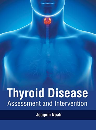 Thyroid Disease Assessment and Intervention [Hardcover]