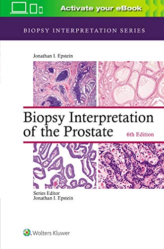 Biopsy Interpretation of the Prostate [Hardcover]