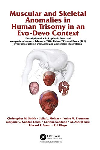 Muscular and Skeletal Anomalies in Human Trisomy in an Evo-Devo Context Descrip [Hardcover]