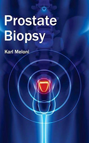 Prostate Biopsy [Hardcover]