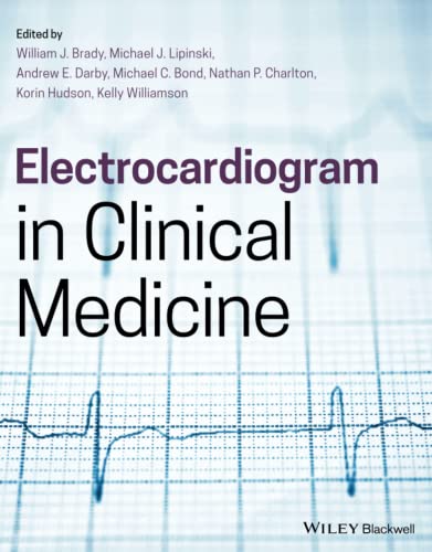 Electrocardiogram in Clinical Medicine [Paperback]