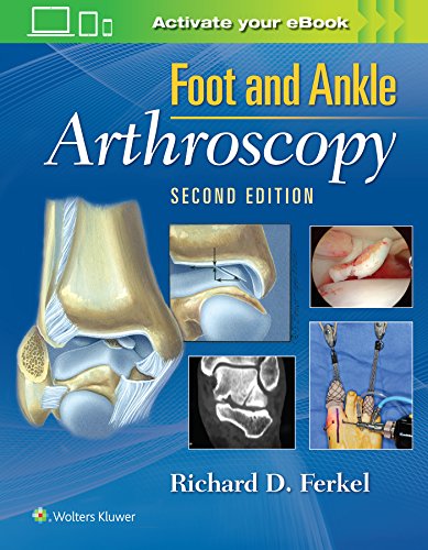 Foot &amp Ankle Arthroscopy [Hardcover]
