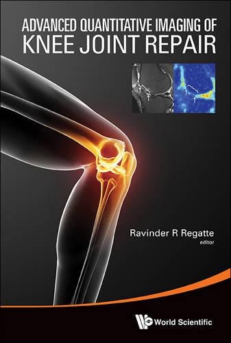 Advanced Quantitative Imaging Of Knee Joint Repair [Hardcover]