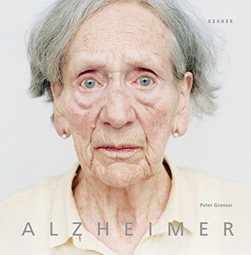 Alzheimer [Hardcover]