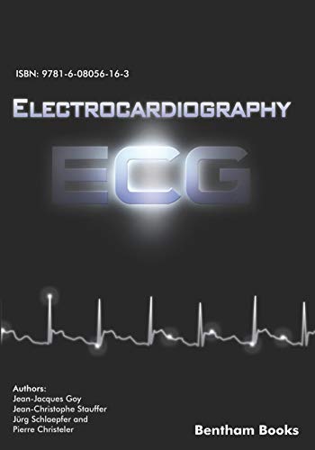 Electrocardiography (ECG) [Paperback]