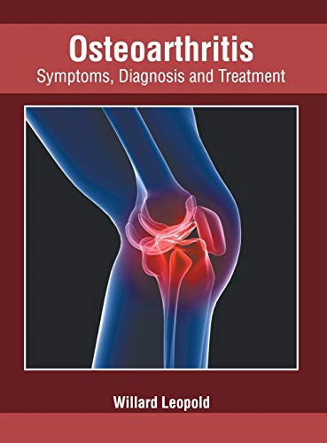 Osteoarthritis Symptoms, Diagnosis and Treatment [Hardcover]