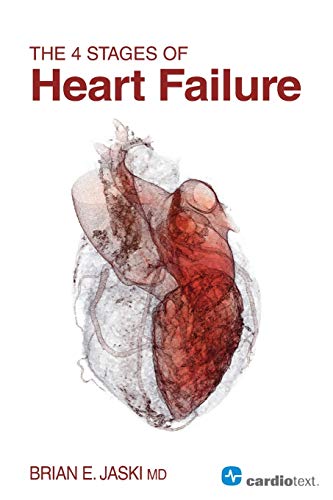4 Stages of Heart Failure [Paperback]