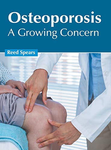 Osteoporosis A Growing Concern [Hardcover]