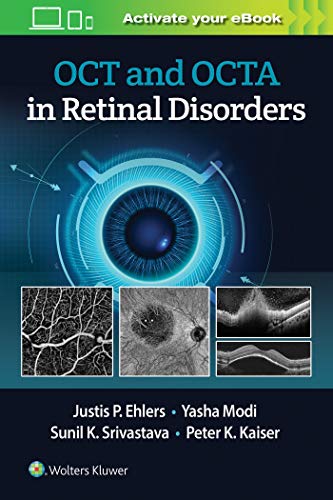 OCT and OCTA in Retinal Disorders [Paperback]