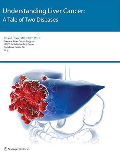 Understanding Liver Cancer A Tale of Two Diseases [Paperback]