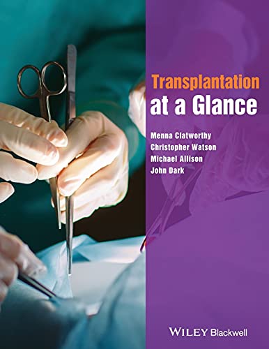 Transplantation at a Glance [Paperback]