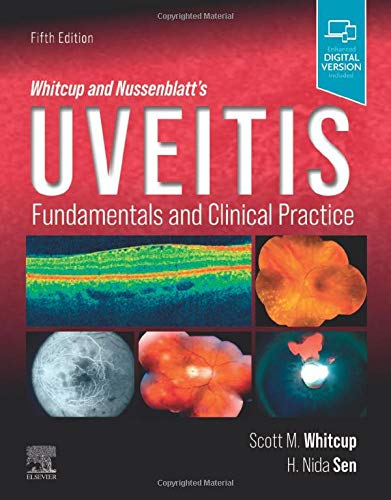 Whitcup and Nussenblatt's Uveitis Fundamentals and Clinical Practice [Hardcover]