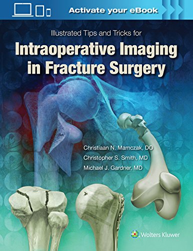 Illustrated Tips and Tricks for Intraoperative Imaging in Fracture Surgery [Hardcover]