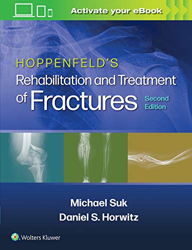 Hoppenfeld&39s Treatment and Rehabilitation of Fractures [Paperback]