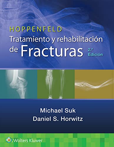 Hoppenfeld. Tratamiento y rehabilitaci&243n de fracturas [Paperback]