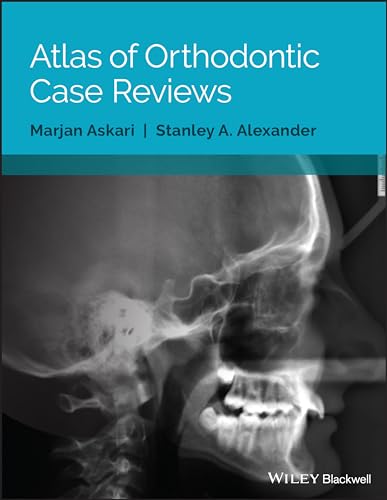 Atlas of Orthodontic Case Reviews [Paperback]