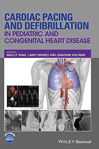 Cardiac Pacing and Defibrillation in Pediatric and Congenital Heart Disease [Hardcover]