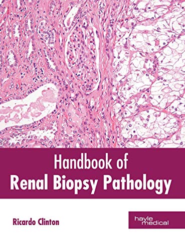 Handbook of Renal Biopsy Pathology [Hardcover]