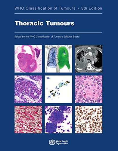 Thoracic Tumours: WHO Classification of Tumours [Paperback]