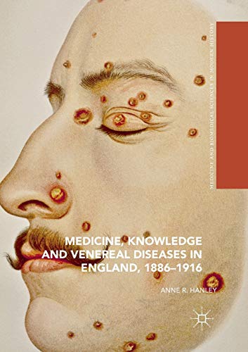 Medicine, Knowledge and Venereal Diseases in England, 1886-1916 [Paperback]