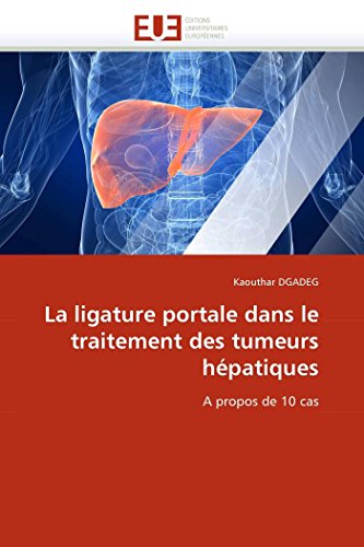 La Ligature Portale Dans Le Traitement Des Tumeurs Hpatiques A Propos De 10 Ca [Paperback]