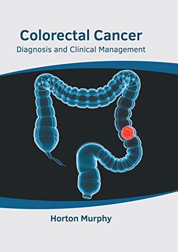 Colorectal Cancer Diagnosis And Clinical Management