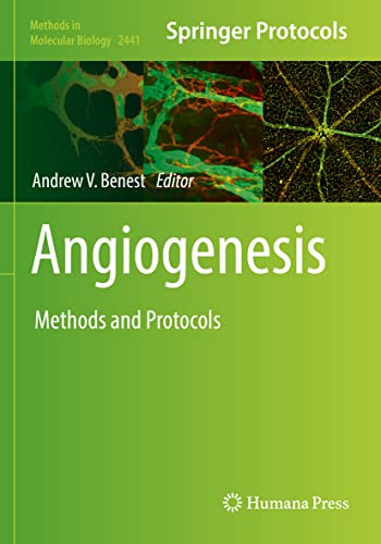 Angiogenesis Methods and Protocols [Paperback]