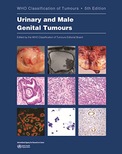 Urinary and Male Genital Tumours (WHO Classification of Tumours, 8) [Paperback]
