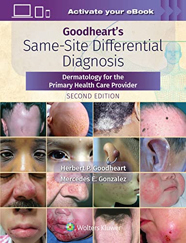 Goodheart&39s Same-Site Differential Diagnosis Dermatology for the Primary He [Hardcover]