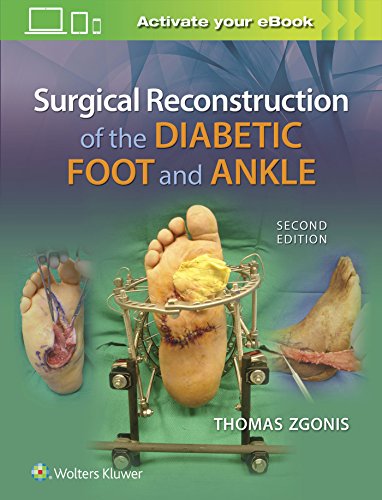 Surgical Reconstruction of the Diabetic Foot and Ankle [Hardcover]