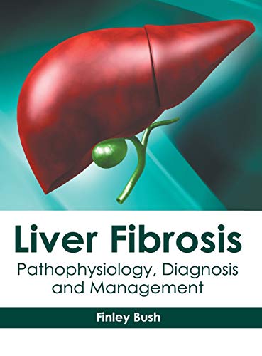 Liver Fibrosis Pathophysiology, Diagnosis and Management [Hardcover]